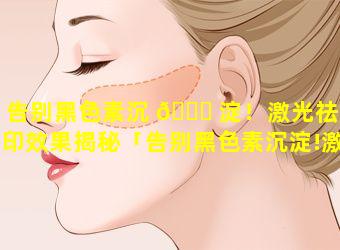 告别黑色素沉 🐕 淀！激光祛痘印效果揭秘「告别黑色素沉淀!激光祛痘印效果揭秘」